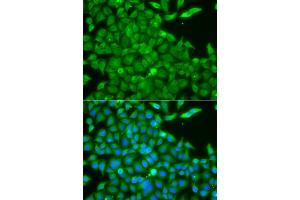 Immunofluorescence analysis of A549 cells using CSNK1G2 antibody. (Casein Kinase 1 gamma 2 anticorps)