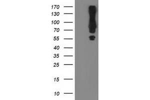 Western Blotting (WB) image for anti-Mahogunin, Ring Finger 1 (MGRN1) antibody (ABIN1499457) (Mahogunin RING Finger Protein 1 anticorps)