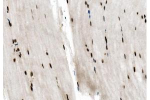 IHC analysis of NFIC using anti-NFIC antibody (ABIN7600653).