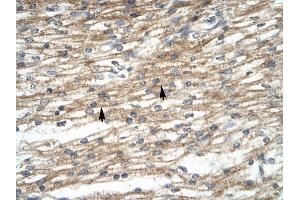 PREB antibody was used for immunohistochemistry at a concentration of 4-8 ug/ml to stain Myocardial cells (arrows) in Human Heart.