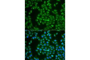 Immunofluorescence analysis of A549 cell using MAP4K3 antibody. (MAP4K3 anticorps)