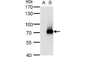 WB Image TRIM32 antibody detects TRIM32 protein by western blot analysis.