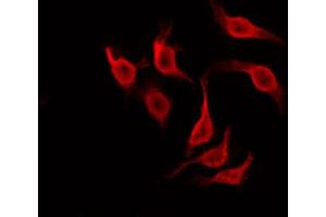 ABIN6266498 staining HeLa by IF/ICC. (NOL3 anticorps  (C-Term))
