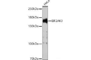 Western blot analysis of extracts of HeLa cells using EIF2AK3 Polyclonal Antibody at dilution of 1:1000. (PERK anticorps)