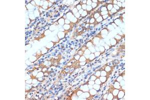 Immunohistochemistry of paraffin-embedded human colon using HHL antibody (ABIN6132190, ABIN6141750, ABIN6141751 and ABIN6217197) at dilution of 1:100 (40x lens).
