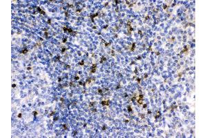 APOBEC3G was detected in paraffin-embedded sections of human tonsil tissues using rabbit anti- APOBEC3G Antigen Affinity purified polyclonal antibody (Catalog # ) at 1 µg/mL.