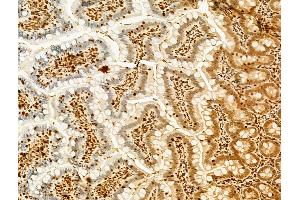 ABIN6256130 and ABIN6267400 at 1/100 staining Rat colon tissue by IHC-P.