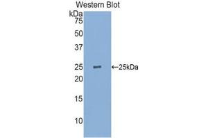 Detection of Recombinant GSTp, Human using Polyclonal Antibody to Glutathione S Transferase Pi (GSTp)