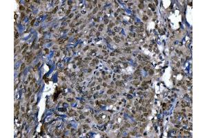 IHC analysis of Ki67/MKI67 using anti-Ki67/MKI67 antibody (ABIN7601873). (Ki-67 anticorps  (AA 5-2358))