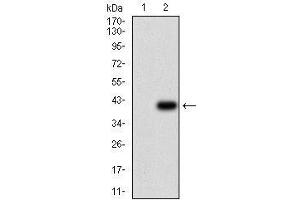 Western blot analysis using ABCB1 mAb against HEK293 (1) and ABCB1 (AA: 632-693)-hIgGFc transfected HEK293 (2) cell lysate. (ABCB1 anticorps  (AA 632-693))