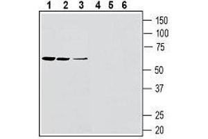 Western blot analysis of rat spleen lysates (lanes 1 and 4), rat lung membranes (lanes 2 and 4) and mouse lung membranes (lanes 3 and 6): - 1-3. (SLC11A1 anticorps  (4th Extracellular Loop))