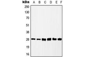 Western blot analysis of CK2 beta (pS209) expression in HEK293T (A), MCF7 (B), HepG2 (C), K562 (D), mouse liver (E), rat spleen (F) whole cell lysates. (CSNK2B anticorps  (C-Term, pSer209))