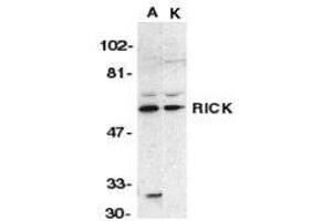 Western Blotting (WB) image for anti-ROP Interactive Partner 2 (RIP2) (N-Term) antibody (ABIN2476367) (RIP2 anticorps  (N-Term))