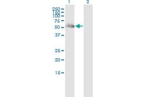 Western Blot analysis of PNKP expression in transfected 293T cell line by PNKP polyclonal antibody (A01).