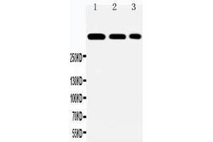 Anti-Laminin 2 alpha antibody, Western blotting Lane 1: HELA Cell Lysate Lane 2: A549 Cell Lysate Lane 3: PANC Cell Lysate (Laminin anticorps  (N-Term))