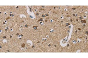 Immunohistochemistry of paraffin-embedded Human brain using COX6B1 Polyclonal Antibody at dilution of 1:50 (COX6B1 anticorps)