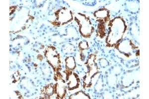 FFPE human renal cell carcinoma tested with Lactadherin antibody (EDM45) (MFGE8 anticorps)