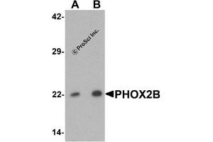 Western Blotting (WB) image for anti-Paired-Like Homeobox 2b (PHOX2B) (Middle Region) antibody (ABIN1031037) (PHOX2B anticorps  (Middle Region))