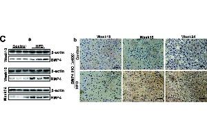 BMP4 expression is elevated during Oleic acid-induced triglyceride/lipid accumulation in hepatocytes and in a mouse model of NAFLD. (BMP4 anticorps)