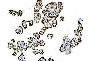 IHC analysis of Histone H1. (Histone H1 anticorps  (AA 20-159))