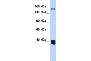 WB Suggested Anti-C10orf12 Antibody Titration: 0. (Lcor anticorps  (Middle Region))