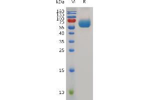 Mouse Protein, hFc Tag on SDS-PAGE under reducing condition.