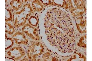 IHC image of ABIN7169084 diluted at 1:300 and staining in paraffin-embedded human kidney tissue performed on a Leica BondTM system. (PKN3 anticorps  (AA 1-252))