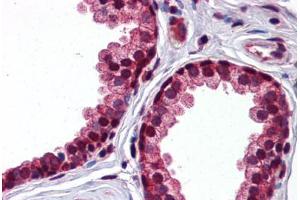 Human Prostate: Formalin-Fixed, Paraffin-Embedded (FFPE)