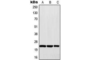 Western blot analysis of MAD2 expression in Raji (A), HepG2 (B), A431 (C) whole cell lysates. (MAD2 anticorps  (Center))