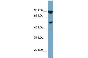 WB Suggested Anti-IRX2 Antibody Titration:  0. (IRX2 anticorps  (N-Term))