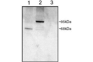Western Blotting (WB) image for phosphodiesterase 4D, cAMP-Specific (PDE4D) peptide (ABIN370400) (phosphodiesterase 4D, cAMP-Specific (PDE4D) Peptide)