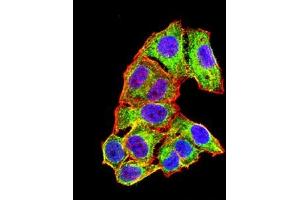 Immunofluorescence analysis of Hela cells using ALB mouse mAb (green). (Albumin anticorps  (AA 410-609))