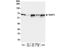 Western Blotting (WB) image for anti-Retinoblastoma Binding Protein 5 (RBBP5) (C-Term) antibody (ABIN7449051)