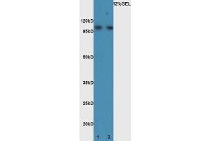 Lane 1:mouse brain lysate probed with Rabbit Anti-BMP1 Polyclonal Antibody, Unconjugated (ABIN873233) at 1:300 overnight at 4 °C. (BMP1 anticorps)