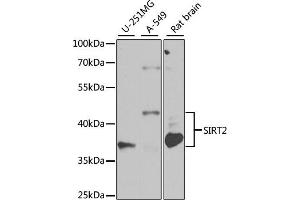 Western blot analysis of extracts of various cell lines, using SIRT2 antibody (ABIN3020851, ABIN3020852, ABIN3020853 and ABIN6213756) at 1:1000 dilution.