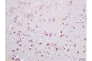 Formalin-fixed and paraffin embedded rat brain labeled with Rabbit Anti-NOX2/gp91phox Polyclonal Antibody, Unconjugated  at 1:200 followed by conjugation to the secondary antibody and DAB staining (CYBB anticorps  (AA 501-570))