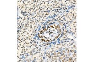 Immunohistochemistry of paraffin embedded rat ovary using Skar (ABIN7074970) at dilution of 1:900 (400x lens) (p46 anticorps)