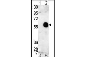 Western blot analysis of AKT2 (arrow) using AKT2 Antibody (C-term) (ABIN391022 and ABIN2841192). (AKT2 anticorps  (C-Term))
