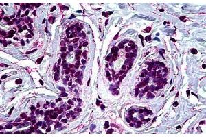 Human Breast: Formalin-Fixed, Paraffin-Embedded (FFPE)