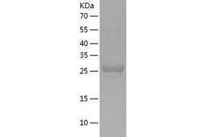 Western Blotting (WB) image for CutC Copper Transporter Homolog (CUTC) (AA 1-273) protein (His-IF2DI Tag) (ABIN7122516)