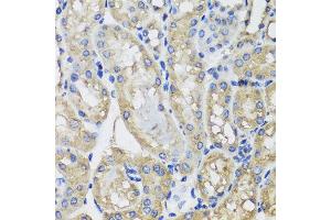 Immunohistochemistry of paraffin-embedded mouse kidney using MRPS22 antibody at dilution of 1:100 (x40 lens). (MRPS22 anticorps)