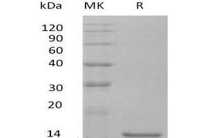 Western Blotting (WB) image for Interleukin 10 (IL10) protein (ABIN7320571) (IL-10 Protéine)