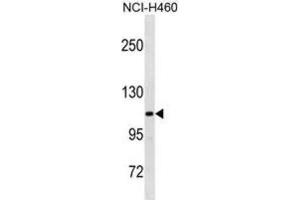 Western Blotting (WB) image for anti-Thrombospondin 4 (THBS4) antibody (ABIN3001104) (THBS4 anticorps)
