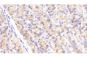 Detection of HDLBP in Human Stomach Tissue using Polyclonal Antibody to High Density Lipoprotein Binding Protein (HDLBP)