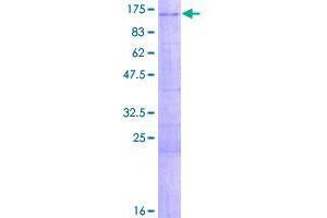 Image no. 1 for Zinc Finger Protein 281 (ZNF281) (AA 1-895) protein (GST tag) (ABIN1326072)