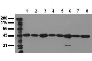 Western Blotting (WB) image for anti-Mitogen-Activated Protein Kinase Kinase 2 (MAP2K2) antibody (ABIN126838) (MEK2 anticorps)