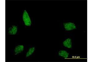 Immunofluorescence of purified MaxPab antibody to BANP on HeLa cell. (BANP anticorps  (AA 1-469))