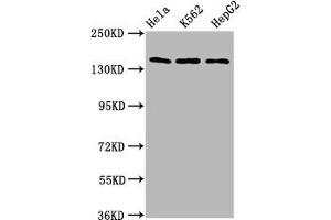 Western Blot Positive WB detected in: Hela whole cell lysate, K562 whole cell lysate, HepG2 whole cell lysate All lanes: SF3B1 antibody at 9.
