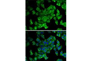 Immunofluorescence analysis of MCF7 cells using PPL antibody (ABIN6128532, ABIN6146036, ABIN6146038 and ABIN6222699). (PPL anticorps  (AA 1-130))