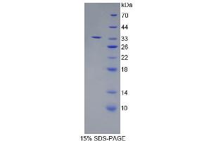 Image no. 1 for Endoplasmic Reticulum Aminopeptidase 2 (ERAP2) (AA 41-271) protein (His tag) (ABIN6237489) (ERAP2 Protein (AA 41-271) (His tag))